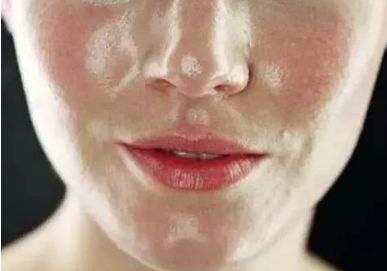 不同膚質(zhì)應該如何正確護膚？