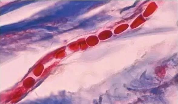 紅血絲形成的原因！