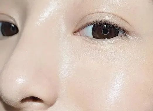 打水光針常見的問題有哪些？