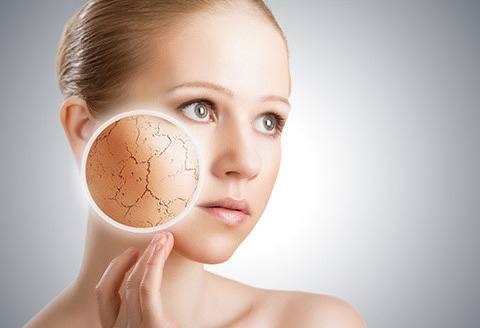 皮膚缺水的表現(xiàn)有哪些？肌膚缺水有什么癥狀？