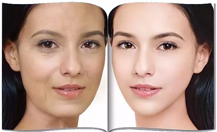 女性抗衰老最好的方法是什么？