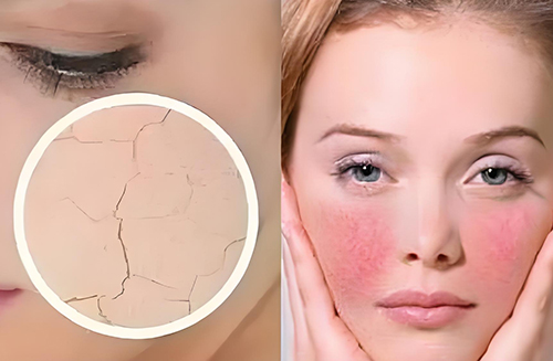 角質(zhì)層變薄還能恢復(fù)嗎？角質(zhì)層變薄怎么恢復(fù)？