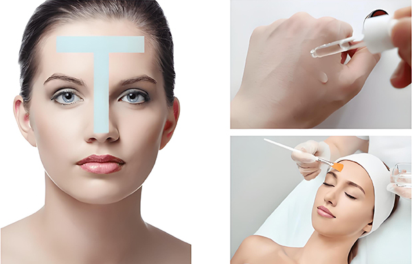 什么是刷酸？刷酸有什么好處？刷酸的好處有哪些？