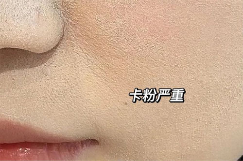 卡粉是什么意思？卡粉是什么原因引起的？