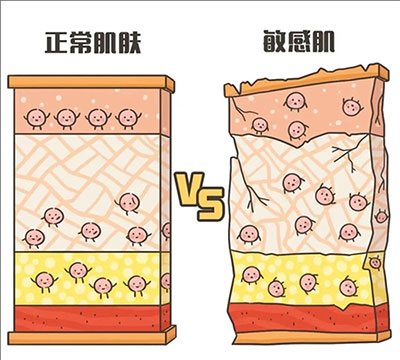 敏感性皮膚產(chǎn)生的原因是什么？