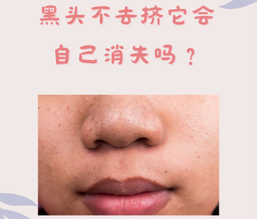 什么是黑頭？怎樣預(yù)防黑頭的形成？