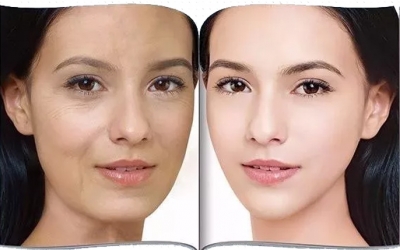 女性抗衰老最好的方法是什么？