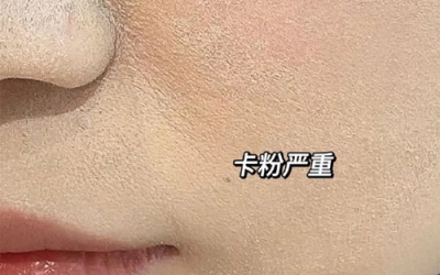 卡粉是什么意思？卡粉是什么原因引起的？